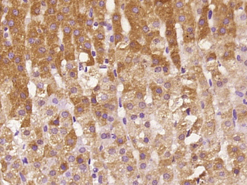 Adenylate cyclase 1 Rabbit Polyclonal Antibody