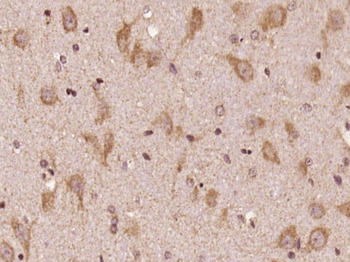 Adenylate cyclase 1 Rabbit Polyclonal Antibody