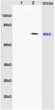 ABCE1 Rabbit Polyclonal Antibody