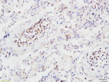 B7H4 Rabbit Polyclonal Antibody