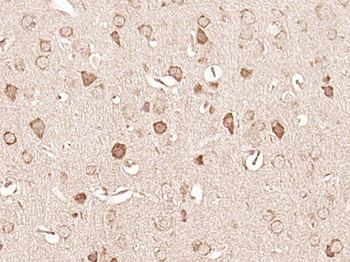 BNIP3L Rabbit Polyclonal Antibody