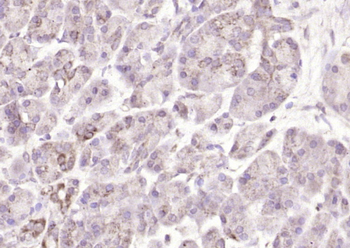 EMAP2 Rabbit Polyclonal Antibody