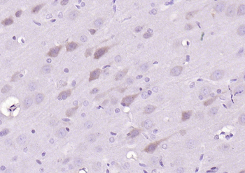 Bad Rabbit Polyclonal Antibody