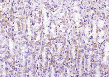 Bad Rabbit Polyclonal Antibody