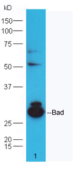 Bad Rabbit Polyclonal Antibody