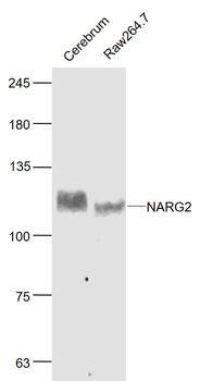 NARG2 Rabbit Polyclonal Antibody