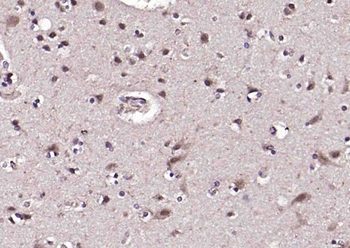 NARG2 Rabbit Polyclonal Antibody