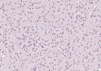 NARG2 Rabbit Polyclonal Antibody