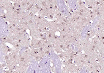 NARG2 Rabbit Polyclonal Antibody