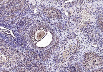 NARG2 Rabbit Polyclonal Antibody