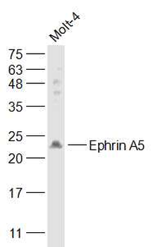 Ephrin A5 Rabbit Polyclonal Antibody