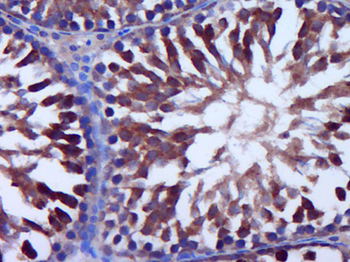 DNTT Rabbit Polyclonal Antibody