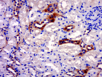 RAB20 Rabbit Polyclonal Antibody