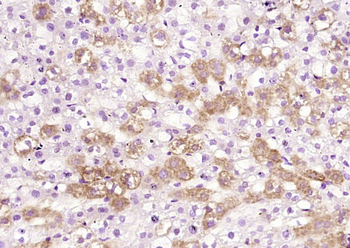 Alpha 2 antiplasmin Rabbit Polyclonal Antibody