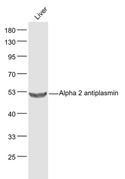 Alpha 2 antiplasmin Rabbit Polyclonal Antibody