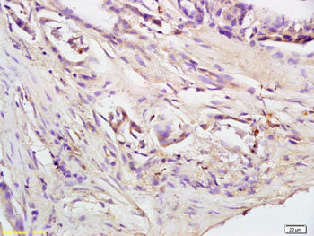 Bak Rabbit Polyclonal Antibody