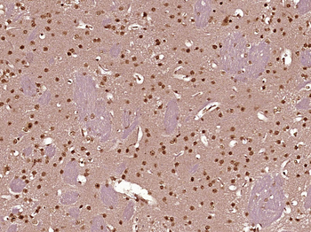 EZH1 Rabbit Polyclonal Antibody