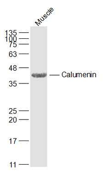 CALU Rabbit Polyclonal Antibody