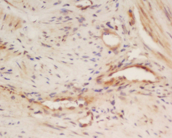 CALU Rabbit Polyclonal Antibody