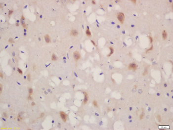 CALU Rabbit Polyclonal Antibody