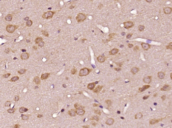 IGF I Rabbit Polyclonal Antibody