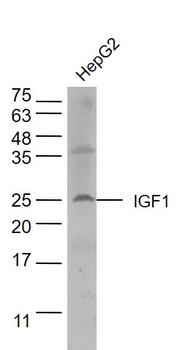 IGF I Rabbit Polyclonal Antibody