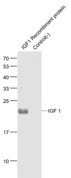 IGF I Rabbit Polyclonal Antibody