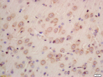 INPPL1 Rabbit Polyclonal Antibody