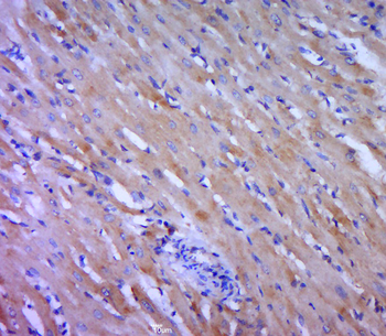 Collagen VIII alpha 1 Rabbit Polyclonal Antibody