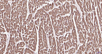 AT2A1/SERCA1 ATPase Rabbit Polyclonal Antibody