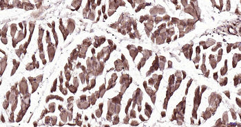 AT2A1/SERCA1 ATPase Rabbit Polyclonal Antibody