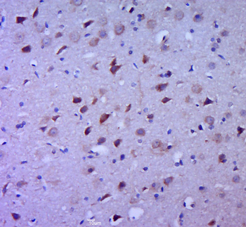 IL-1 Beta Rabbit Polyclonal Antibody