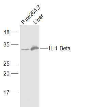IL-1 Beta Rabbit Polyclonal Antibody