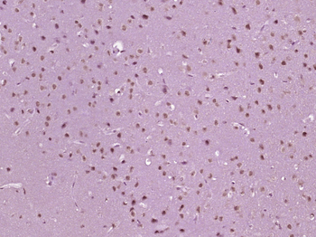 MIER2 Rabbit Polyclonal Antibody