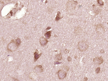 VGF Rabbit Polyclonal Antibody