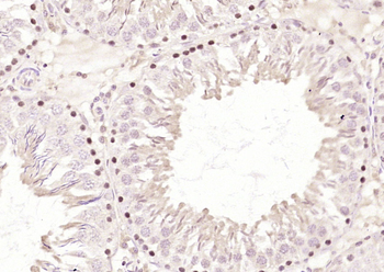 RNF36 Rabbit Polyclonal Antibody