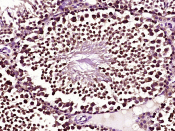 BCL2L1 Rabbit Polyclonal Antibody