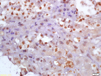Glutamine PRPP amidotransferase Rabbit Polyclonal Antibody
