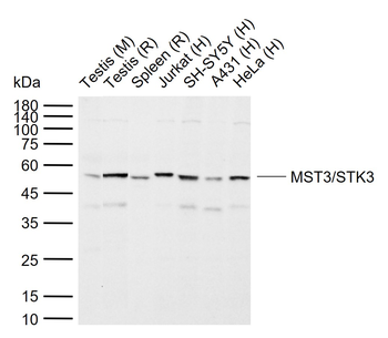 MST3/STK3 Rabbit Polyclonal Antibody