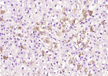 PARP4 Rabbit Polyclonal Antibody