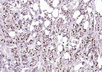 BRD7 Rabbit Polyclonal Antibody