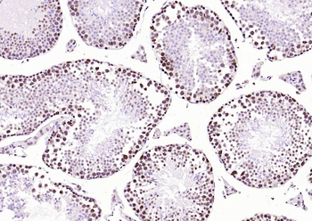 BRD7 Rabbit Polyclonal Antibody