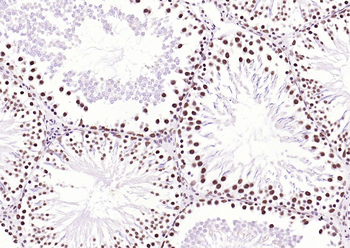 BRD7 Rabbit Polyclonal Antibody