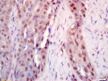 BRD7 Rabbit Polyclonal Antibody