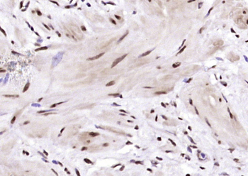 BRD7 Rabbit Polyclonal Antibody
