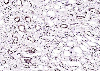 BRD7 Rabbit Polyclonal Antibody