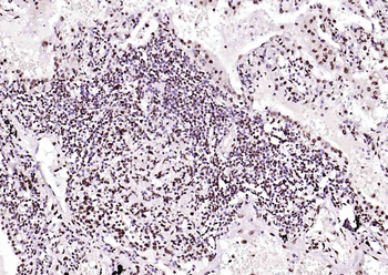 BRD7 Rabbit Polyclonal Antibody