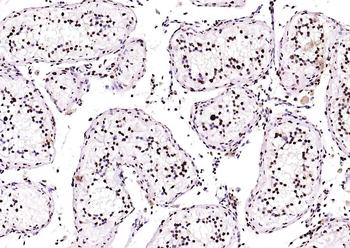 BRD7 Rabbit Polyclonal Antibody