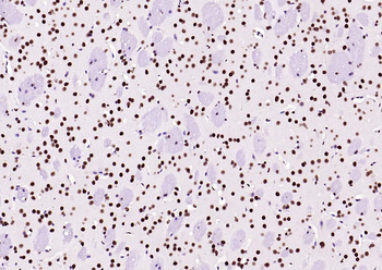 BRD7 Rabbit Polyclonal Antibody