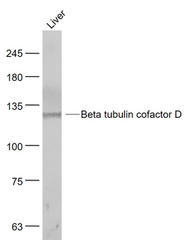 Beta tubulin cofactor D Rabbit Polyclonal Antibody